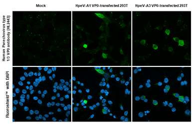 Anti-Human Parechovirus 1+3 VP0 antibody [HL2443] used in Immunocytochemistry/ Immunofluorescence (ICC/IF). GTX638759
